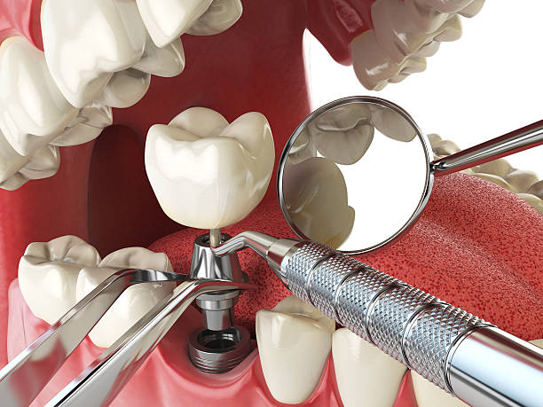 Best Same-Day Emergency Dentist in Springfield, MI